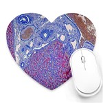 Histology Inc Histo Logistics Incorporated Human Liver Rhodanine Stain Copper Heart Mousepads Front